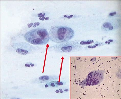 what is coccobacilli in pap smear|Mga video ng what is coccobacilli in pap smear.